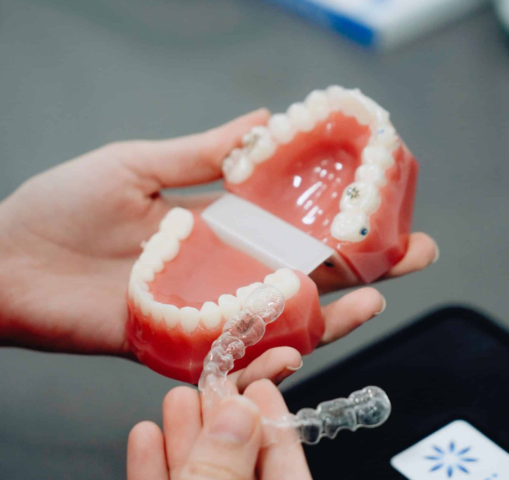 Benefits of Invisalign